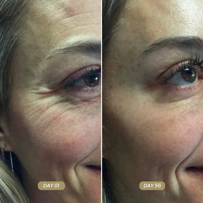 LumiVive™ Face RED Light Therapy Sculptor